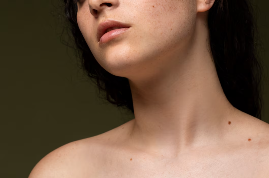 Acne Problem: Main Causes, Symptoms, and Effective Treatment Methods